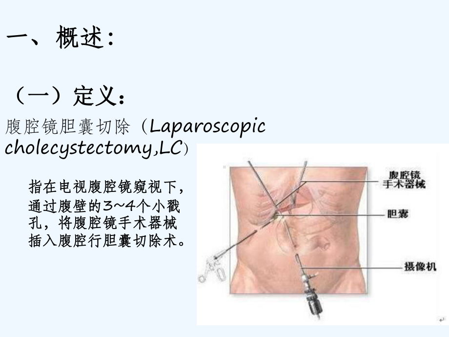 腹腔镜胆囊切除术后病人护理课件.ppt_第3页