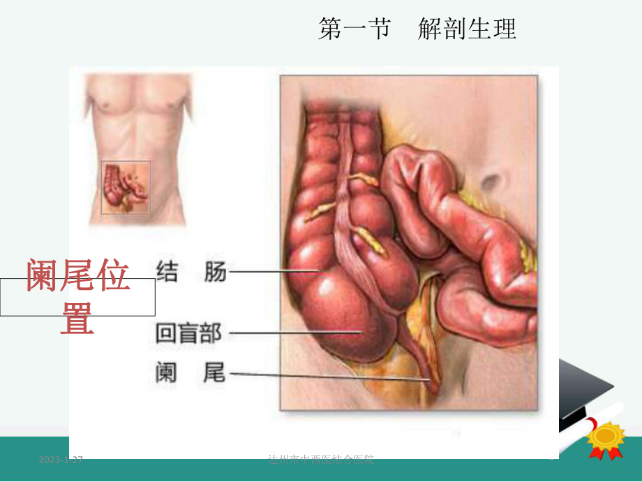 阑尾疾病课件.pptx_第3页