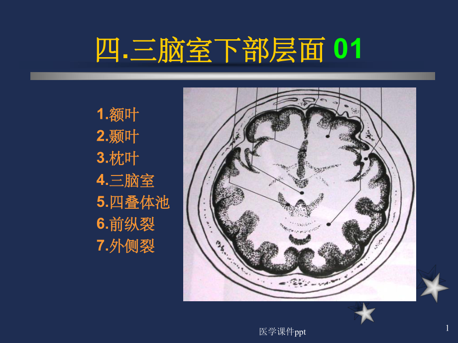 脑室下部层面解剖要点课件.ppt_第1页