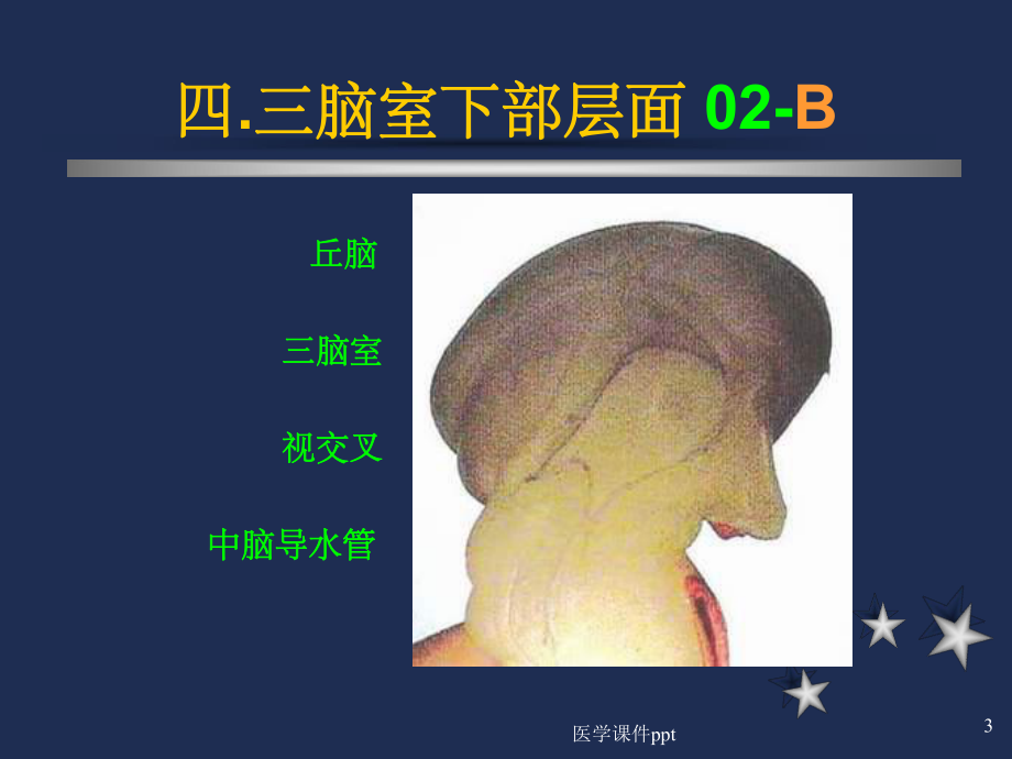 脑室下部层面解剖要点课件.ppt_第3页