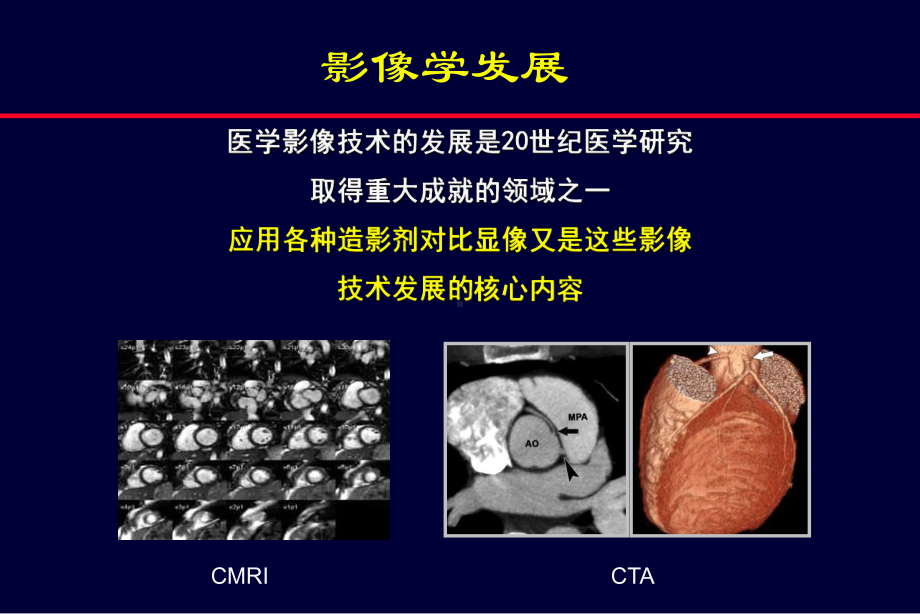 超声造影剂的研发及应用-课件.ppt_第3页