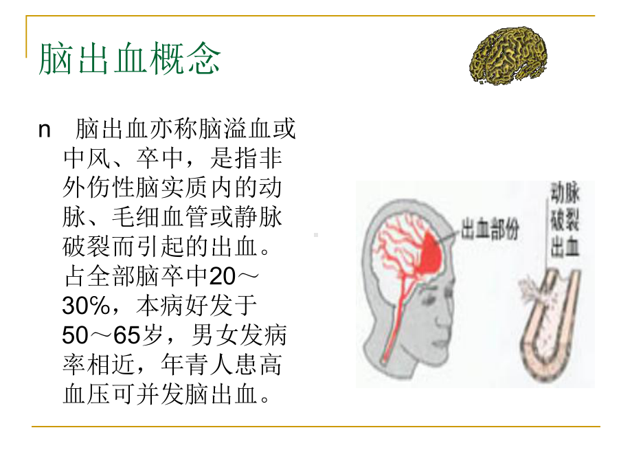 2月份护理查房脑出血课件.ppt_第1页