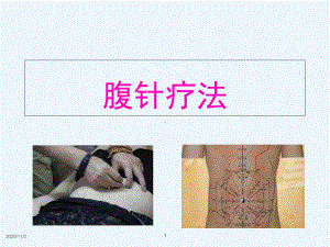 腹针疗法幻灯课件.ppt