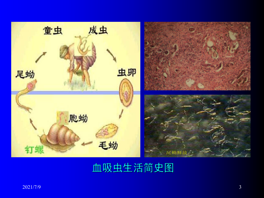 (教学培训课件）第三章第7节食源性寄生虫及危害.ppt_第3页