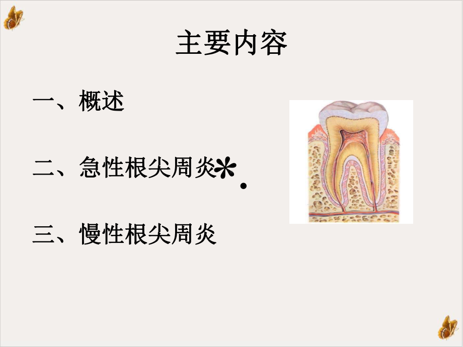 根尖周炎实用课件.ppt_第2页