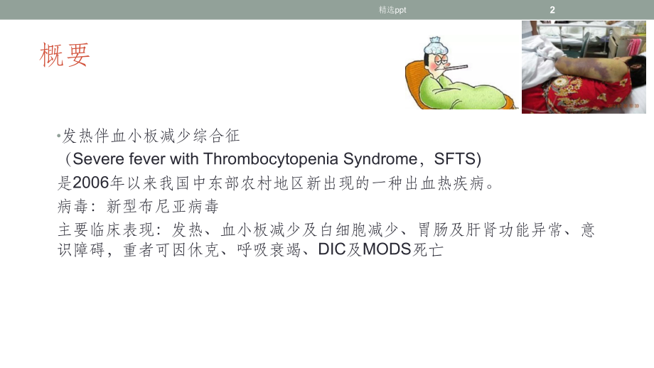 发热伴血小板减少及鉴别诊断课件整理.ppt_第2页