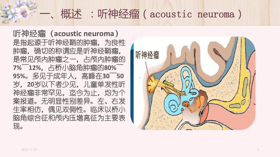 听神经瘤的护理查房(课堂)课件.pptx_第3页