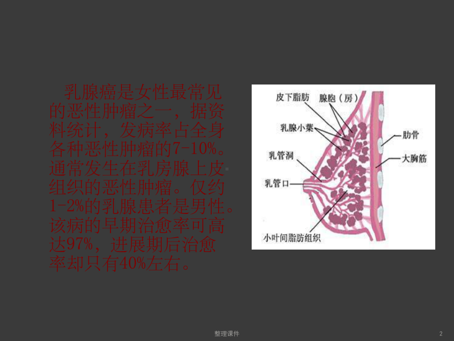 乳腺癌护理查房(同名1087)课件.ppt_第2页