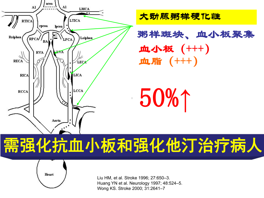 动脉粥样硬化性梗死分层病例课件.pptx_第3页