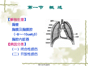 三十胸部损伤病人护理课件.pptx