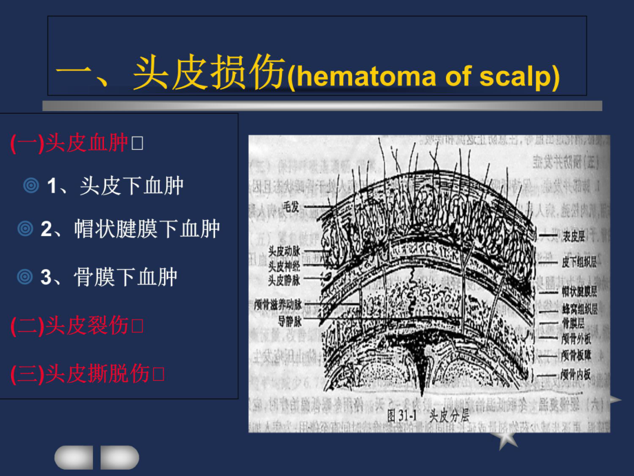 [基础医学]颅脑损伤护理课件.ppt_第3页