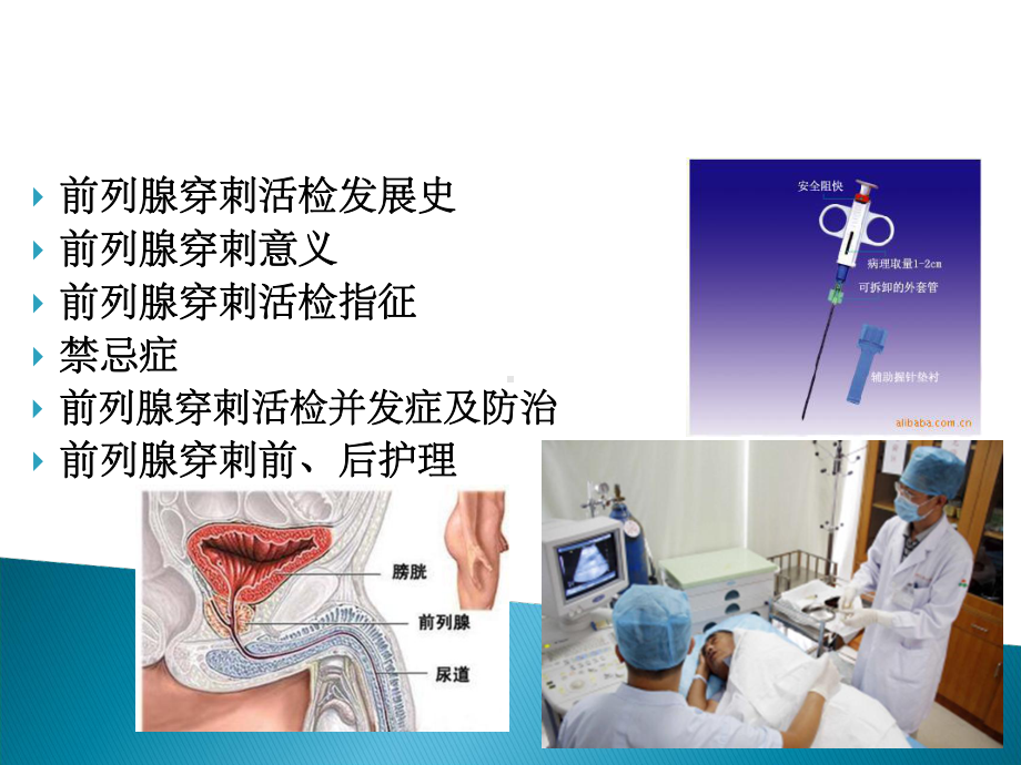 前列腺穿刺活检课件.ppt_第2页