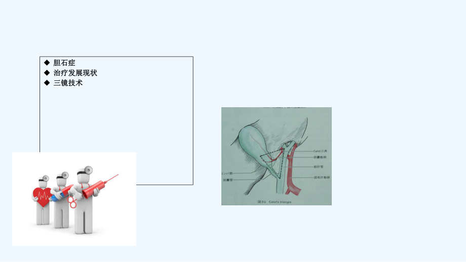 三镜联合治疗胆总管取石护理课件.ppt_第3页