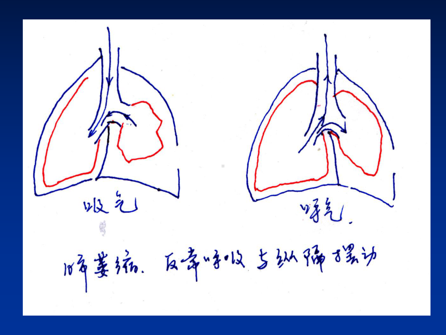 《临床麻醉学》胸科手术的麻醉课件.ppt_第3页