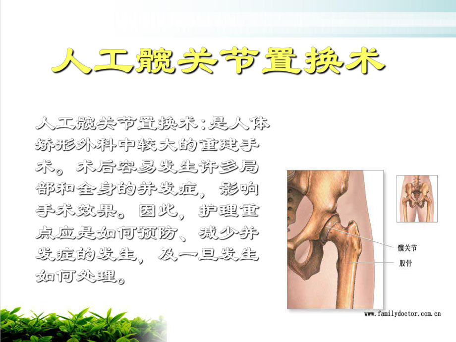 人工关节置换术护理课件.ppt_第2页