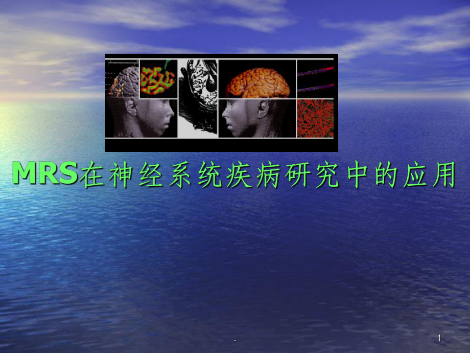 MRS在神经系统疾病研究中的应用课件.ppt_第1页