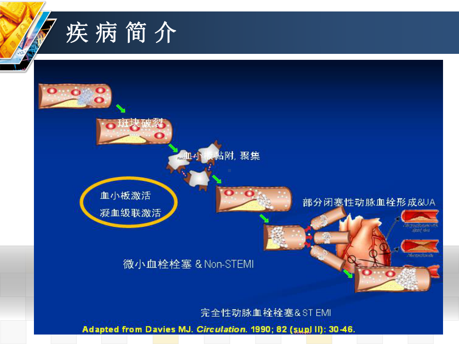 一例抗血小板药物消化道损伤患者的药学监护课件.ppt_第3页