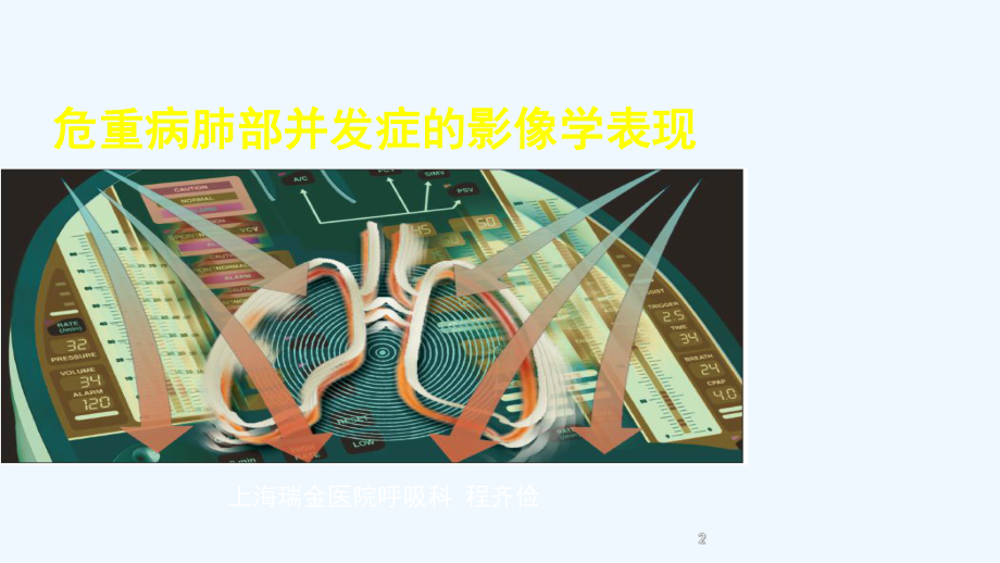 危重病肺部并发症的影像学表现课件.ppt_第2页