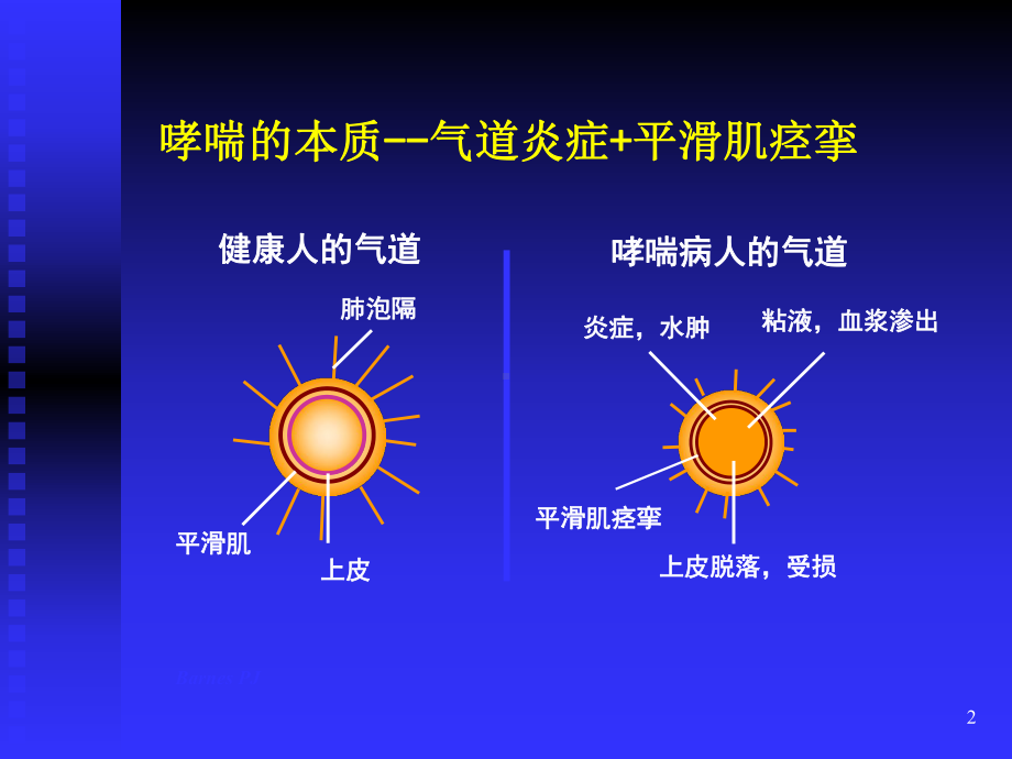 《呼吸药物使用》教学课件.ppt_第2页