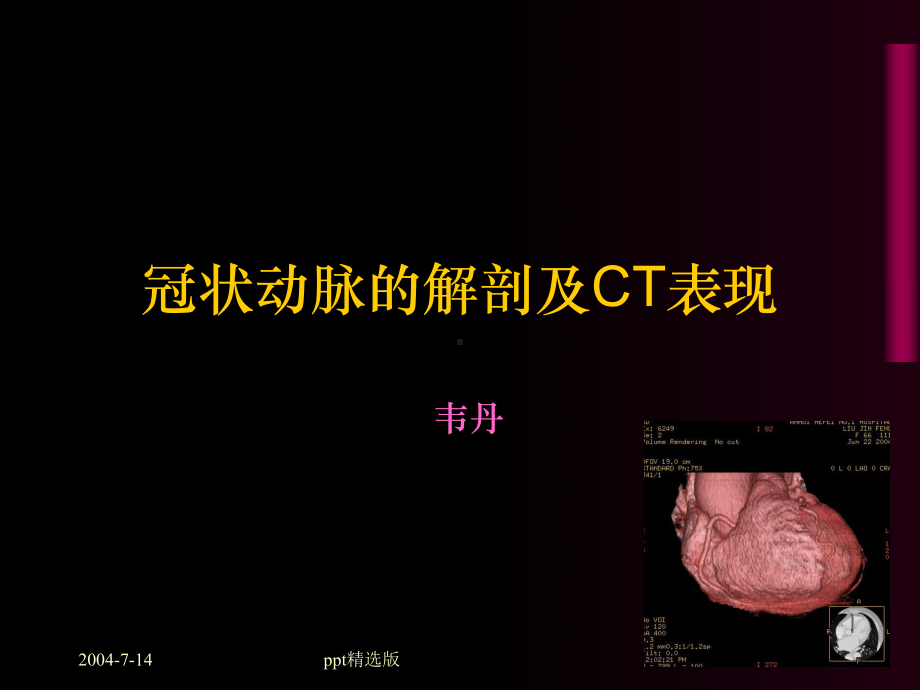 冠状动脉的解剖及CT表现课件.ppt_第1页