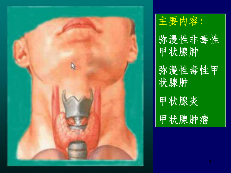 内分泌系统疾病(同名1103)课件.ppt_第2页