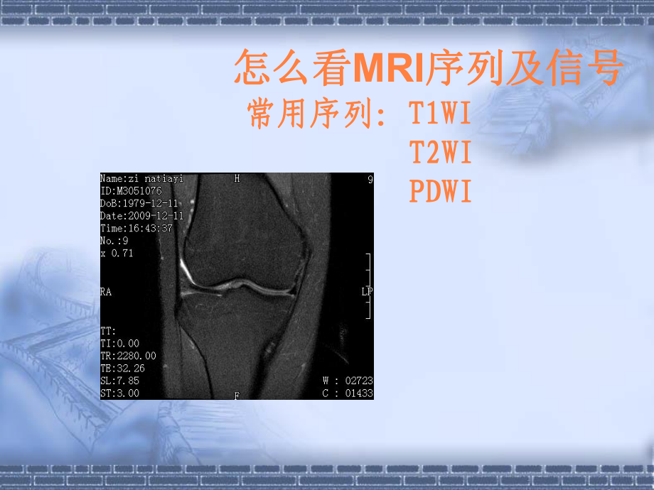 mri的诊断与临床课件.ppt_第2页