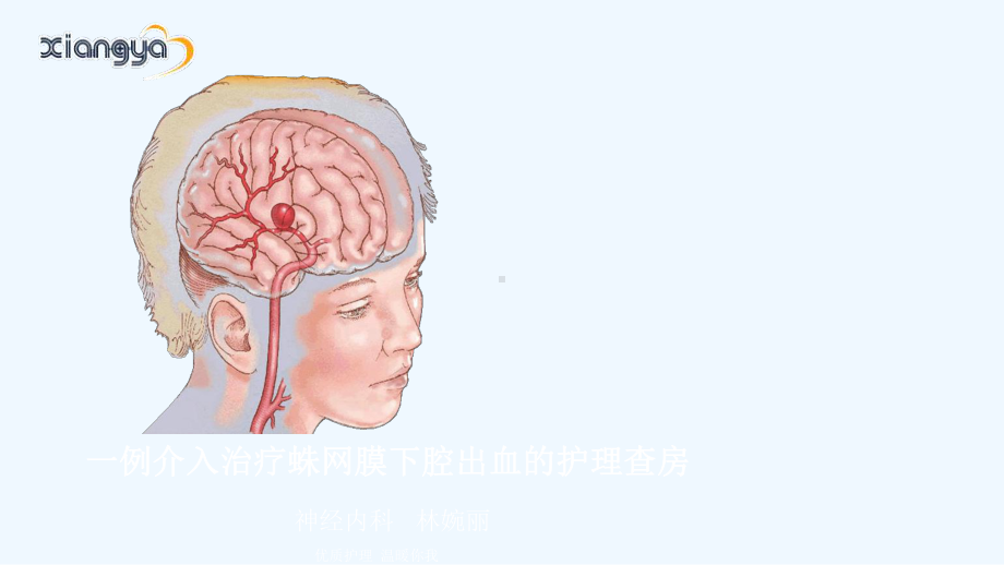 一例介入治疗蛛网膜下腔出血的护理查房课件.ppt_第2页