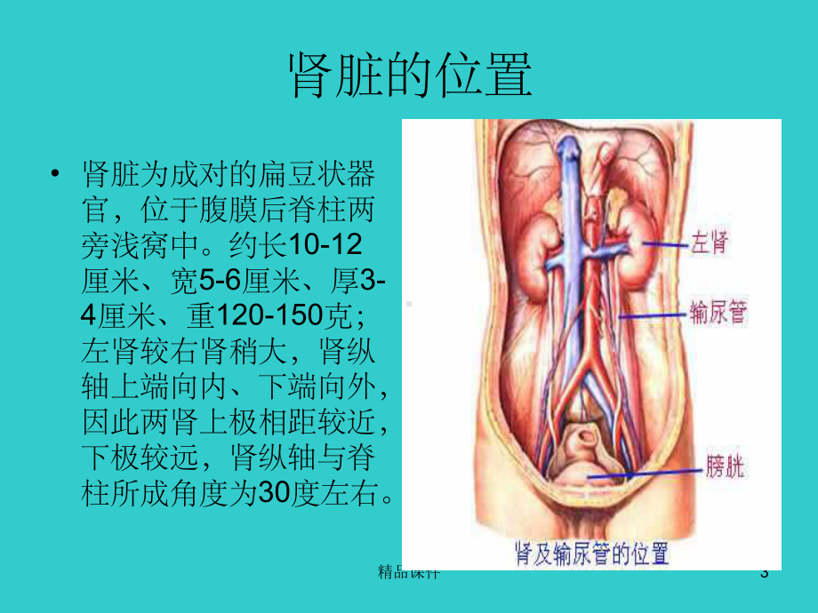 体外碎石治疗肾及输尿管结石与体外泌尿系统碎石课件.ppt_第3页