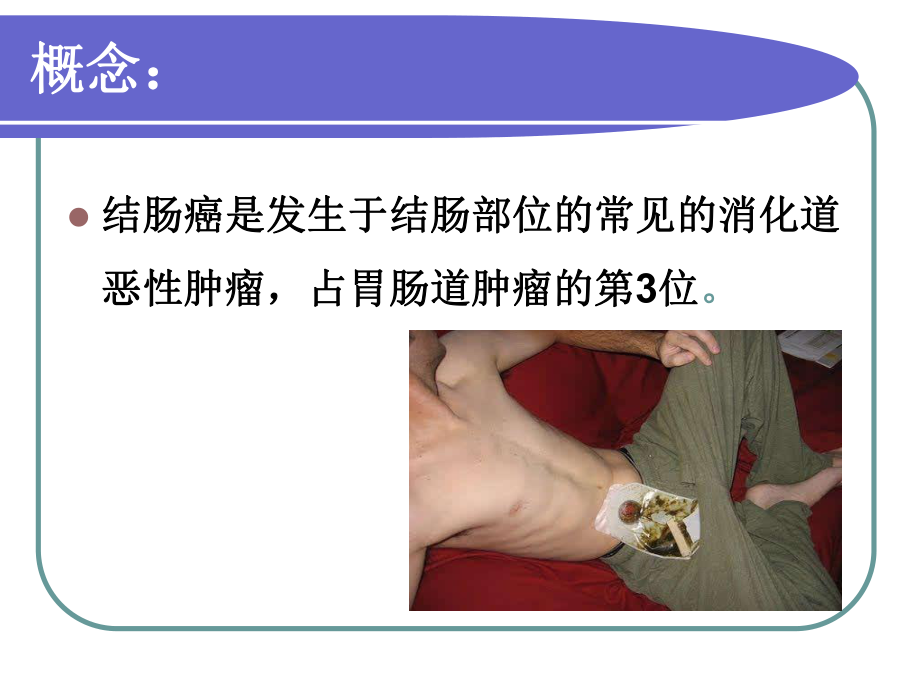 一例结肠癌患者的护理查房课件.ppt_第3页