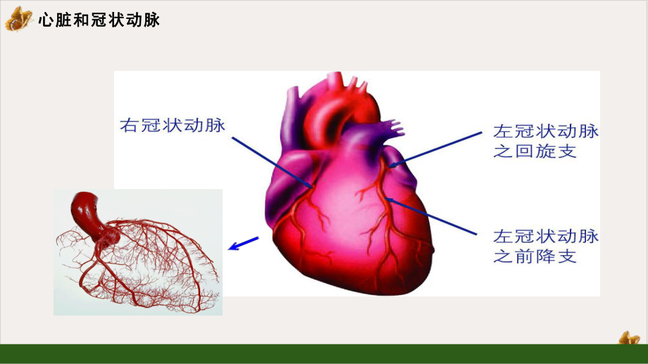 冠心病的诊断与治疗权威之作教学课件.pptx_第2页