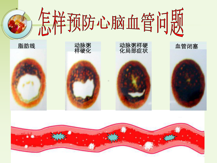 《怎样清洗血管》课件.ppt_第1页