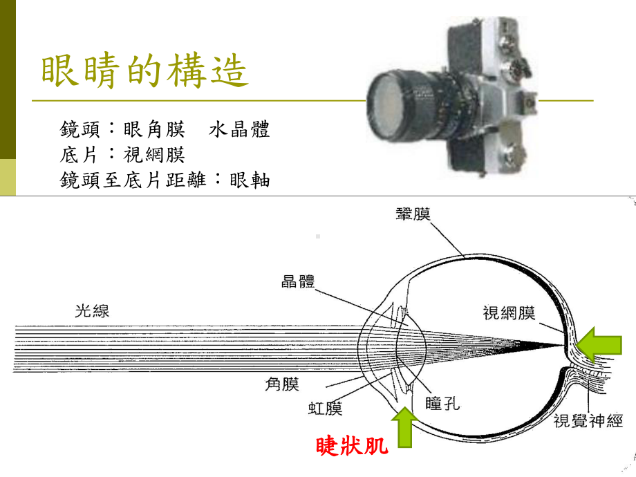 医学儿童常见眼科疾病课件.ppt_第3页