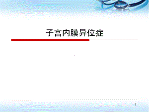 子宫内膜异位症(课堂)课件.ppt