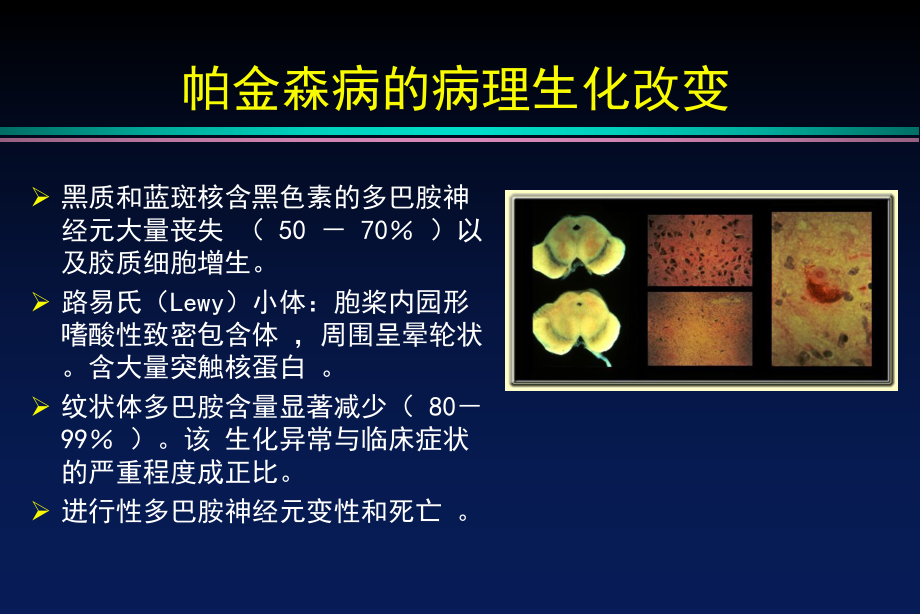 PD帕金森氏病的诊断及其治疗课件.ppt_第3页