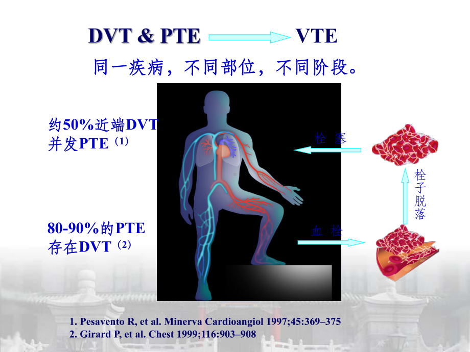 dvtpte的诊断与治疗课件.ppt_第3页