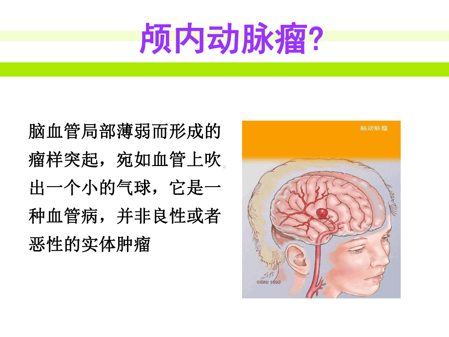 动脉瘤患者护理查房课件.ppt_第2页