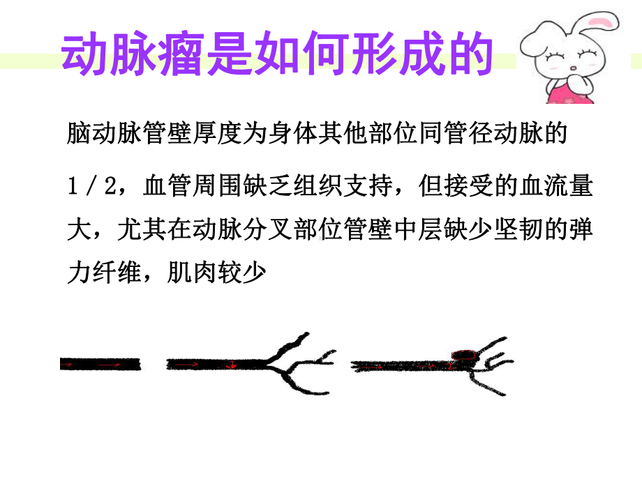 动脉瘤患者护理查房课件.ppt_第3页