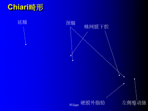 《头部CT诊断》课件.ppt