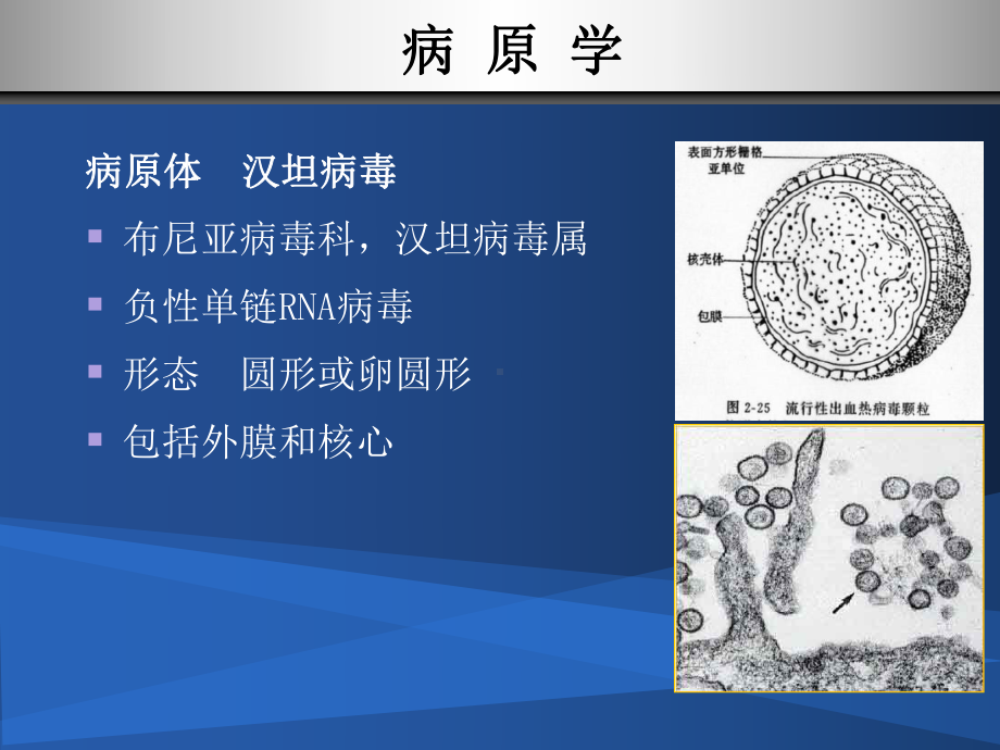 传染-流行性出血热-1课件.ppt_第3页