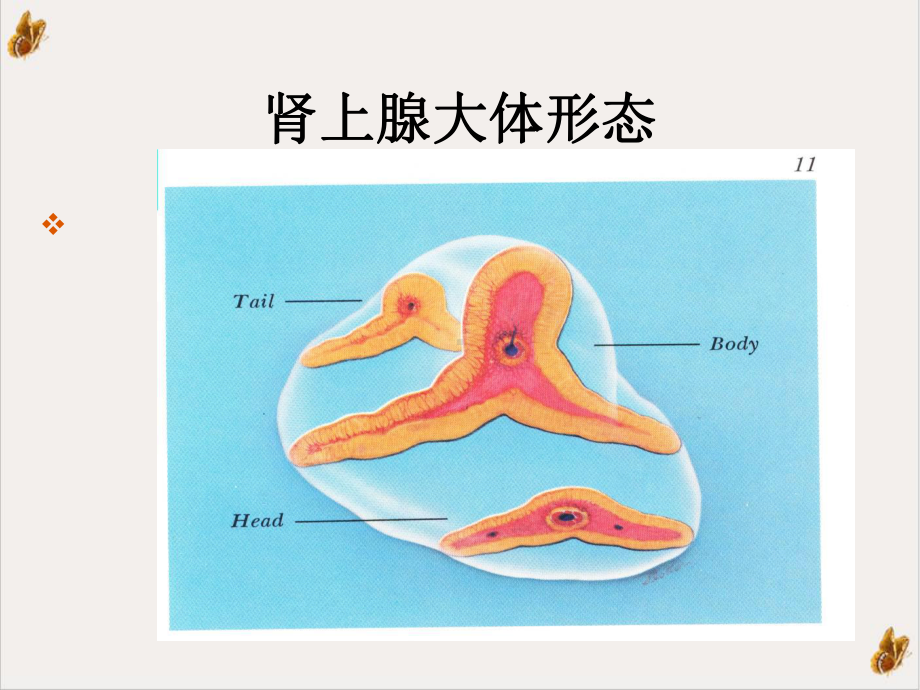 内科学课件cushing综合征优质.ppt_第2页