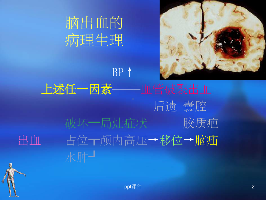 （大学课件）脑出血(Cerebral-Haemorrahge).ppt_第2页