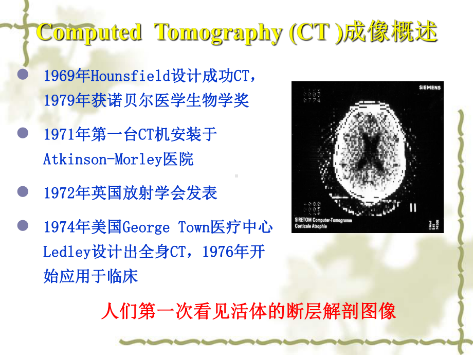 CT成像原理及应用课件.ppt_第2页