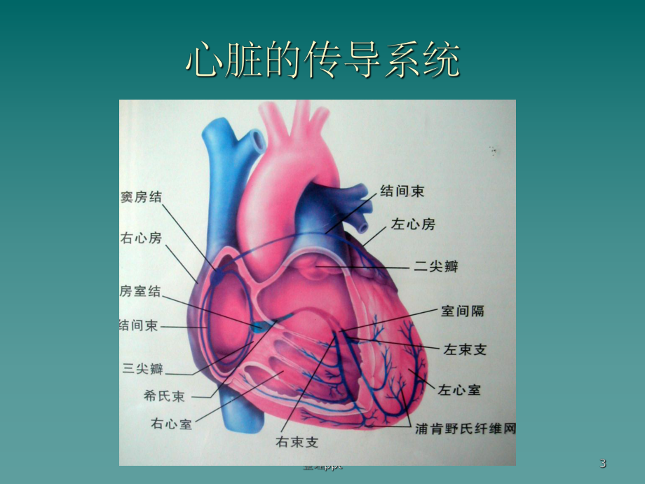 《ICU常见心律失常》课件.ppt_第3页