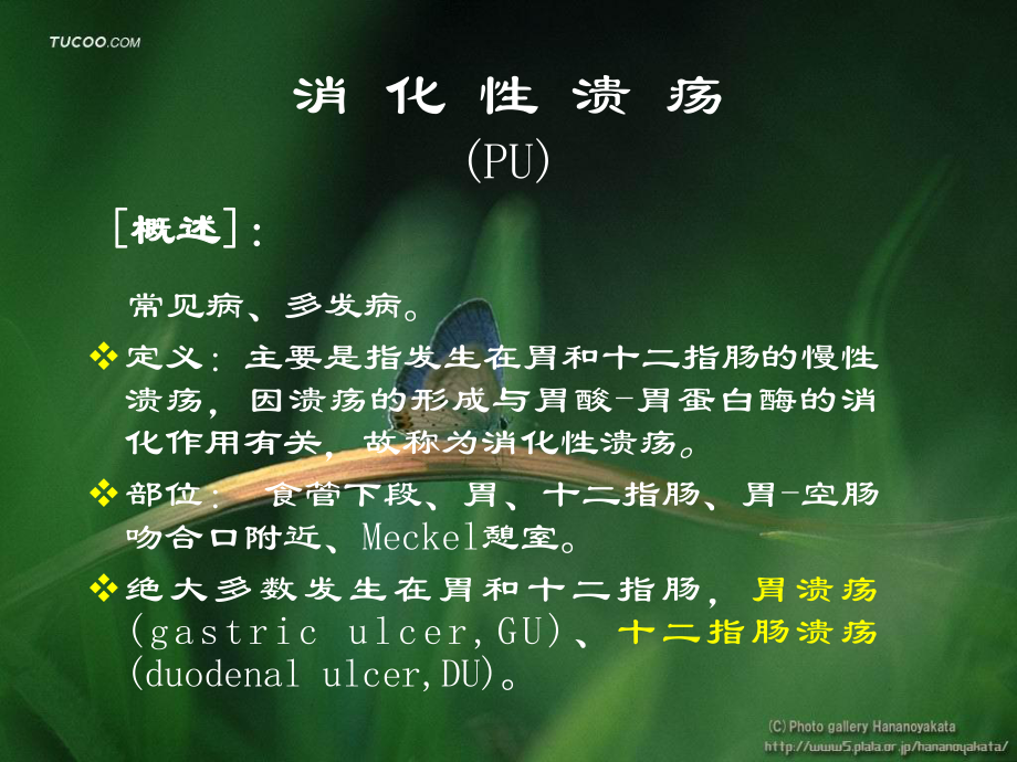 医学消化性溃疡课件.ppt_第3页