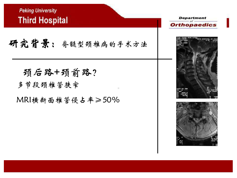 一期前后路手术与单纯后路手术治疗脊髓型颈椎病的比较解读课件.pptx_第2页