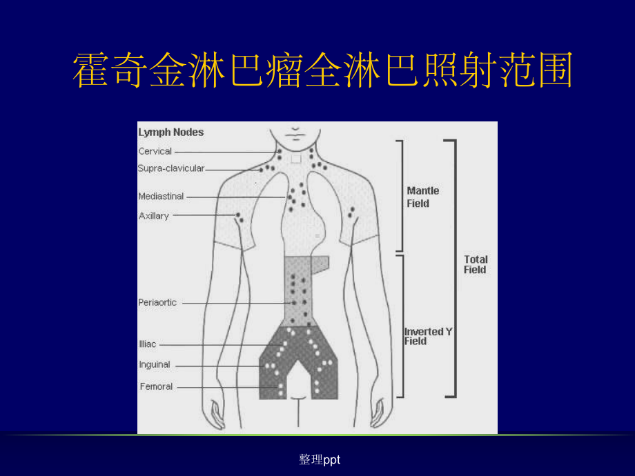 《淋巴瘤放疗指南》课件.ppt_第3页