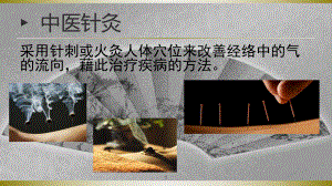 中医针灸与病原生物课件.ppt