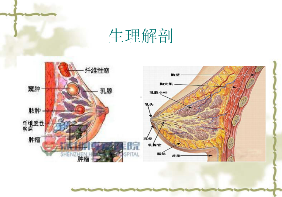 乳腺癌护理查房(同名508)课件.ppt_第2页