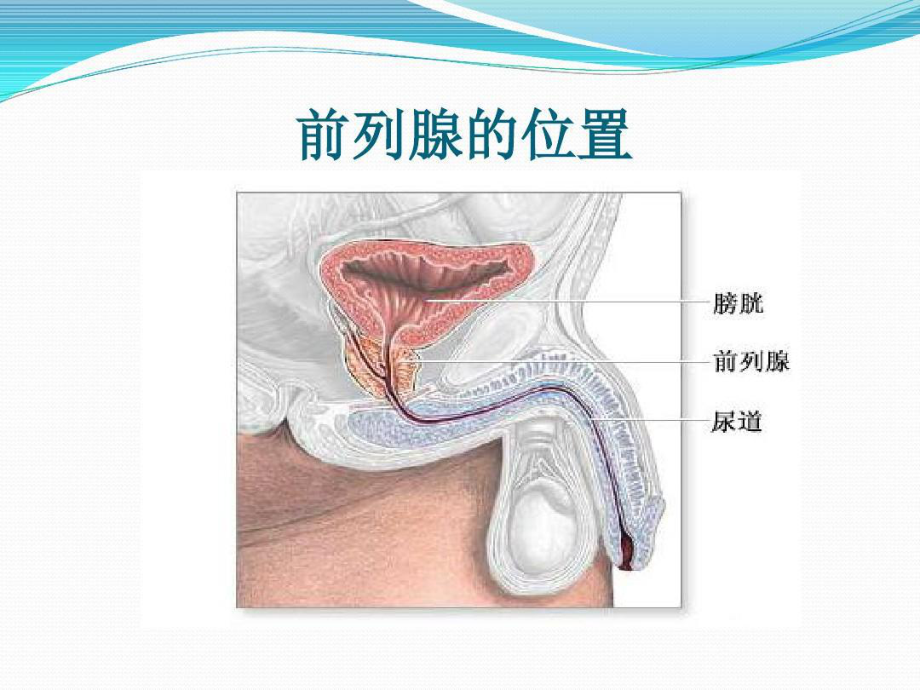 前列腺穿刺术的护理课件.ppt_第3页