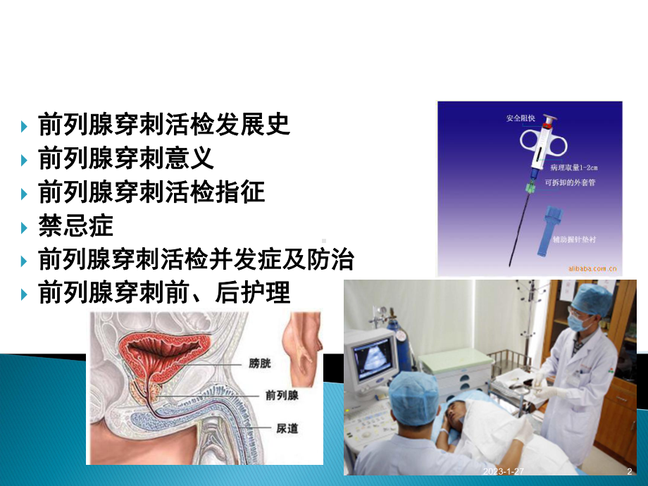 前列腺穿刺活检(课堂)课件.ppt_第2页